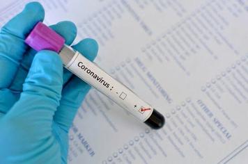 Paraíso do Sul confirma primeiro caso de Coronavírus